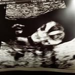 Alien baby needs no Halloween costume.